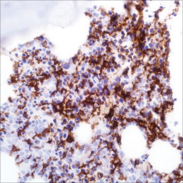 CD16 (SP175) Rabbit Monoclonal Antibody