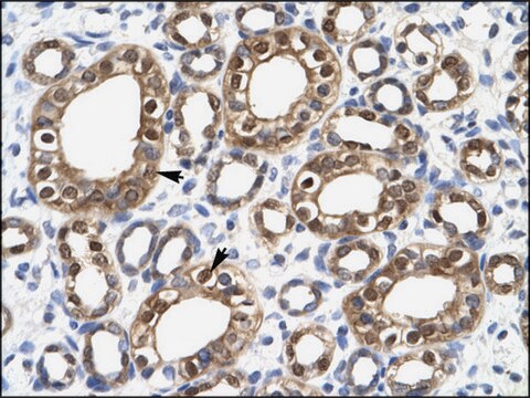 Anti-ENO1 antibody produced in rabbit affinity isolated antibody