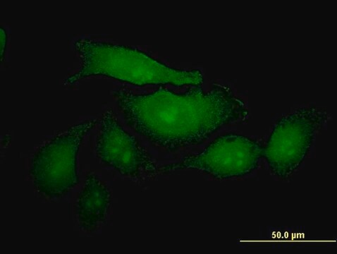 ANTI-MUC2 antibody produced in mouse clone 2A9, purified immunoglobulin, buffered aqueous solution