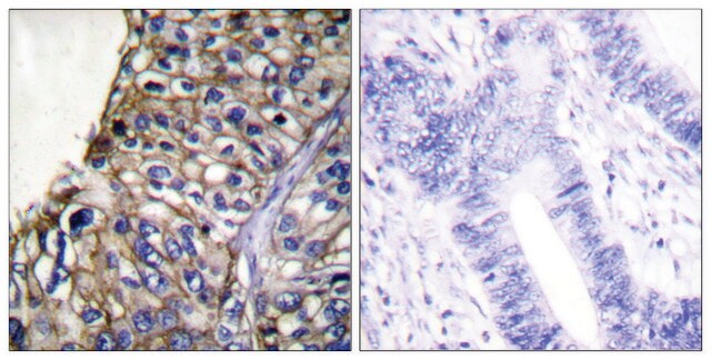 Anti-Claudin 7 antibody produced in rabbit affinity isolated antibody