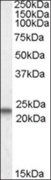 Anti-CAV3 (N-terminal) antibody produced in goat affinity isolated antibody, buffered aqueous solution