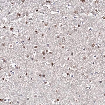 Anti-ZNF655 antibody produced in rabbit Prestige Antibodies&#174; Powered by Atlas Antibodies, affinity isolated antibody, buffered aqueous glycerol solution