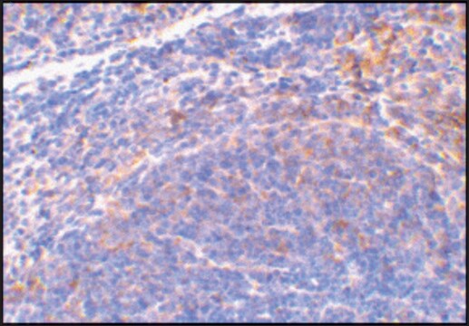 Anti-SMAC antibody produced in rabbit affinity isolated antibody, buffered aqueous solution