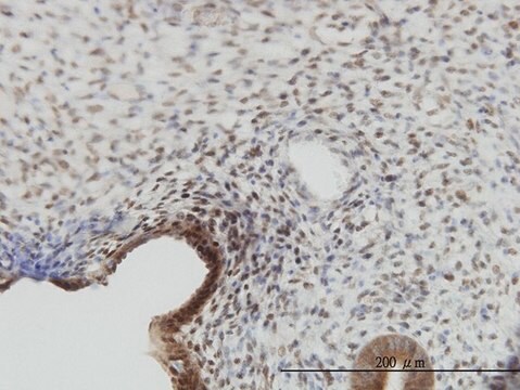 モノクローナル抗YAP1 マウス宿主抗体 clone 2F12, purified immunoglobulin, buffered aqueous solution