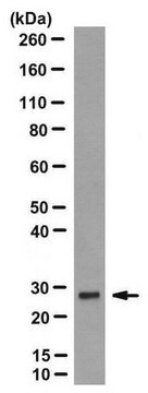 Anti-Kallikrein 7 (KLK7) Antibody, clone 83-1 clone 83-1, from mouse