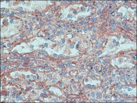 Anti-FHOD1 antibody produced in rabbit ~1.0&#160;mg/mL, affinity isolated antibody