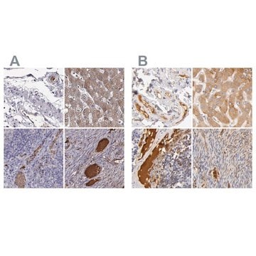 Anti-TF antibody produced in rabbit Ab2, Prestige Antibodies&#174; Powered by Atlas Antibodies, affinity isolated antibody, buffered aqueous glycerol solution