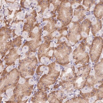 Anti-ADAM8 antibody produced in rabbit Prestige Antibodies&#174; Powered by Atlas Antibodies, affinity isolated antibody, buffered aqueous glycerol solution