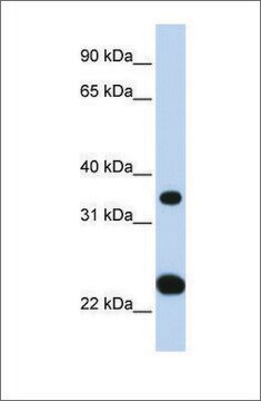 Anti-SLC25A35 antibody produced in rabbit affinity isolated antibody