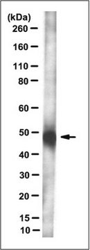 Anti-MLN64/STARD3 Antibody, clone 2BE-2F4 ascites fluid, clone 2BE-2F4, from mouse