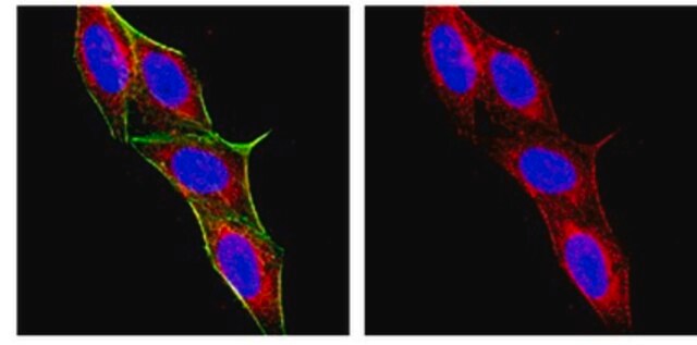 Anti-Macrophages/Granulocytes Antibody, clone OX-41 clone OX-41, Chemicon&#174;, from mouse