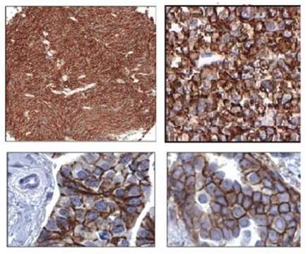 Anti-ROR2 Antibody, clone Nt 2535-2835 clone Nt2535-2835, from mouse