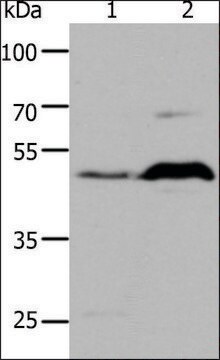 Anti-5HT1A antibody produced in rabbit affinity isolated antibody