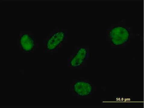 Anti-BAP1 antibody produced in mouse purified immunoglobulin, buffered aqueous solution