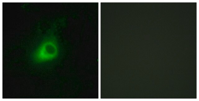 Anti-GRK6 antibody produced in rabbit affinity isolated antibody