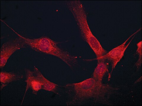 Anti-Coronin 1B antibody produced in rabbit ~1.5&#160;mg/mL, affinity isolated antibody