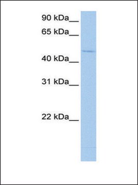 Anti-RBM45 affinity isolated antibody