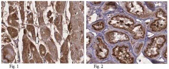 Anti-BAG family molecular chaperone regulator 3 (BAG3) Antibody from rabbit, purified by affinity chromatography