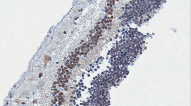 Anti-OTX2 Antibody from rabbit, purified by affinity chromatography