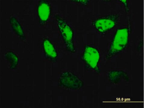 Monoclonal Anti-TCF4 antibody produced in mouse clone 1G4, purified immunoglobulin, buffered aqueous solution