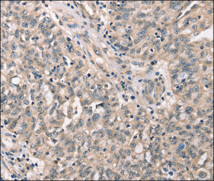 Anti-CDK12 antibody produced in rabbit affinity isolated antibody