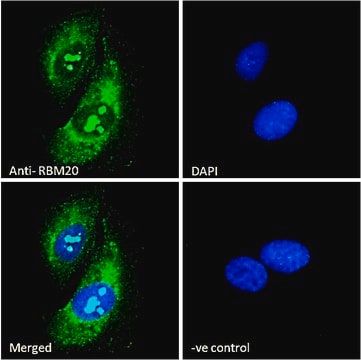 Anti-RBM20 antibody produced in goat affinity isolated antibody, buffered aqueous solution