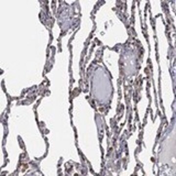 Anti-LIMD1 antibody produced in rabbit Prestige Antibodies&#174; Powered by Atlas Antibodies, affinity isolated antibody, buffered aqueous glycerol solution