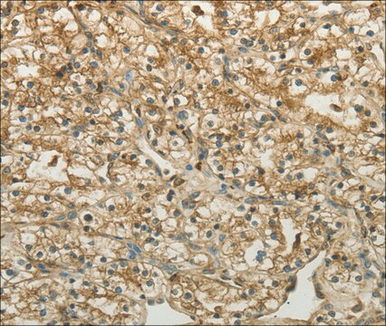 Anti-CTSV antibody produced in rabbit affinity isolated antibody