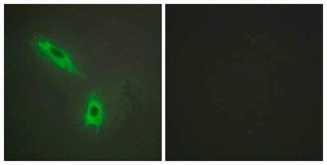 Anti-TNFC antibody produced in rabbit affinity isolated antibody