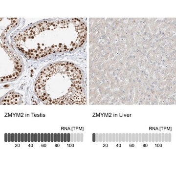 Anti-ZMYM2 antibody produced in rabbit Prestige Antibodies&#174; Powered by Atlas Antibodies, affinity isolated antibody, buffered aqueous glycerol solution