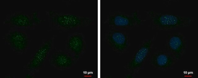 Monoclonal Anti-TERF1 antibody produced in mouse