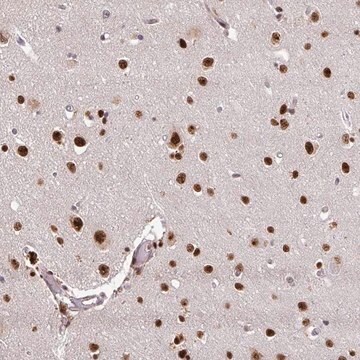 Anti-U2AF1 antibody produced in rabbit Prestige Antibodies&#174; Powered by Atlas Antibodies, affinity isolated antibody, buffered aqueous glycerol solution