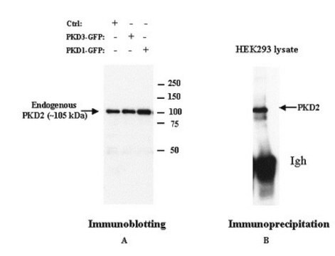 Anti-PKD2 Rabbit pAb liquid, Calbiochem&#174;