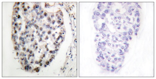 Anti-MYF5 antibody produced in rabbit affinity isolated antibody