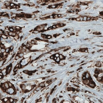 Monoclonal Anti-MTDH antibody produced in mouse Prestige Antibodies&#174; Powered by Atlas Antibodies, clone CL0397, purified immunoglobulin, buffered aqueous glycerol solution