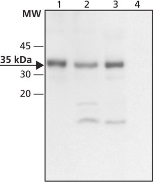 Anti-CHIP (C-terminal) antibody produced in rabbit ~1&#160;mg/mL, affinity isolated antibody, buffered aqueous solution