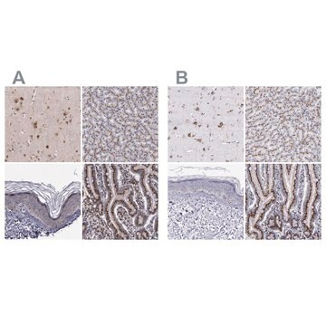 Anti-GOLIM4 antibody produced in rabbit Ab2, Prestige Antibodies&#174; Powered by Atlas Antibodies, affinity isolated antibody, buffered aqueous glycerol solution