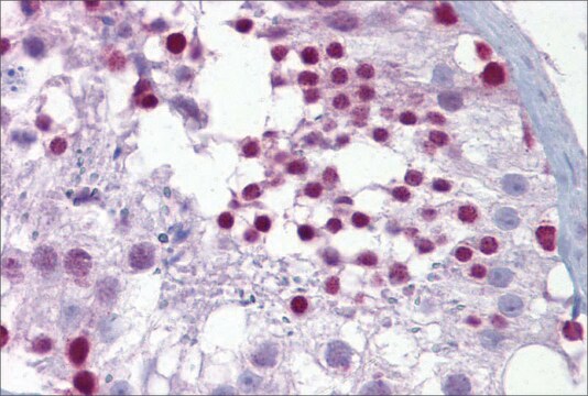 Anti-PITX3 antibody produced in rabbit affinity isolated antibody