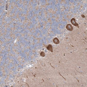 Anti-WDR49 antibody produced in rabbit Prestige Antibodies&#174; Powered by Atlas Antibodies, affinity isolated antibody, buffered aqueous glycerol solution