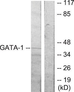 Anti-GATA1 antibody produced in rabbit affinity isolated antibody