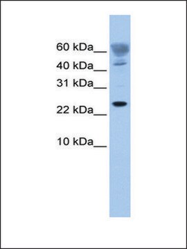 Anti-FUNDC1 (AB2) antibody produced in rabbit affinity isolated antibody