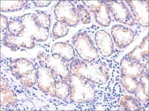 Monoclonal Anti-TSG101 antibody produced in mouse