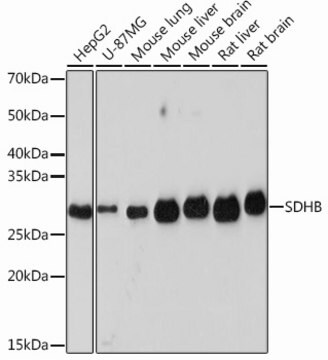 Anti-SDHB Antibody, clone 9S1A0, Rabbit Monoclonal