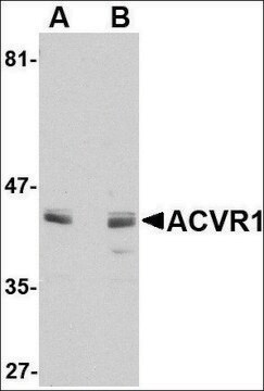 Anti-ACVR1 antibody produced in rabbit affinity isolated antibody, buffered aqueous solution