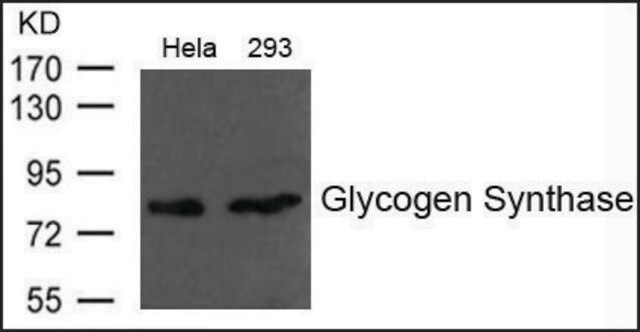 Anti-Glycogen Synthase antibody produced in rabbit affinity isolated antibody