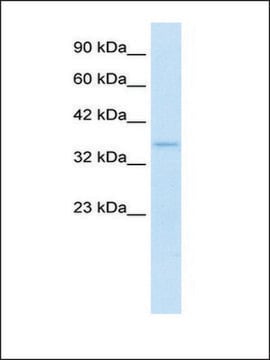 Anti-SHOX2 antibody produced in rabbit affinity isolated antibody