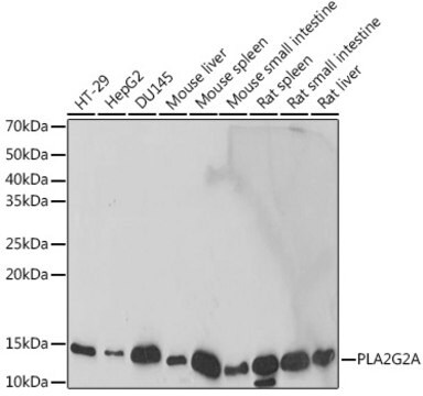 Anti-PLA2G2A Antibody, clone 3X9F5, Rabbit Monoclonal