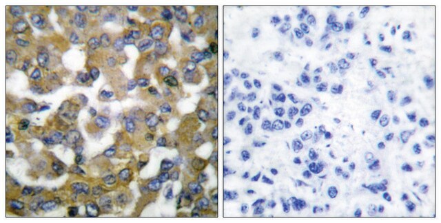 Anti-Keratin 19 antibody produced in rabbit affinity isolated antibody