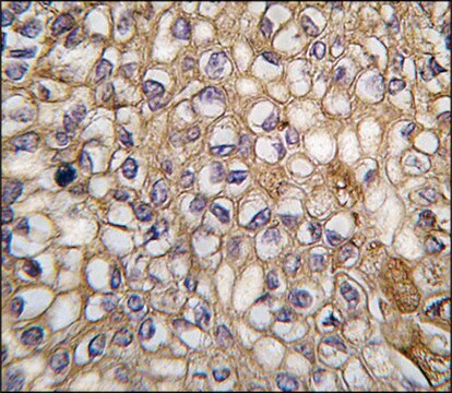 Anti-ALOX5AP (C-term) antibody produced in rabbit saturated ammonium sulfate (SAS) precipitated, buffered aqueous solution