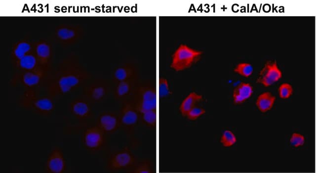 Anti-Phosphothreonine antibody, Rabbit monoclonal recombinant, expressed in HEK 293 cells, clone RM102, purified immunoglobulin